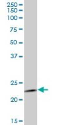 Western Blot: RAB1B Antibody (1B2) [H00081876-M02]