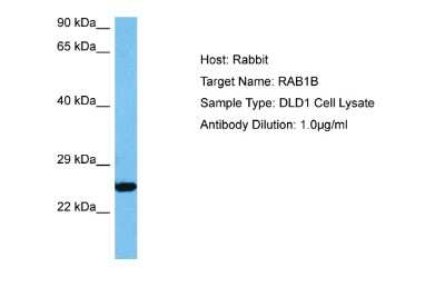 Western Blot: RAB1B Antibody [NBP2-86760]