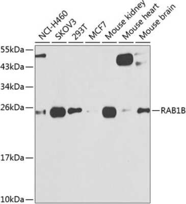 Western Blot: RAB1B AntibodyBSA Free [NBP2-93131]