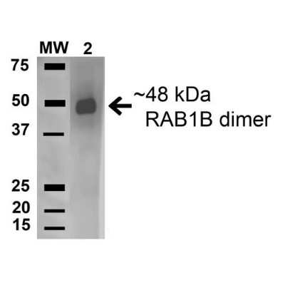 Western Blot: RAB1B Antibody [NBP3-18251]