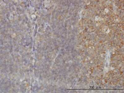 Immunohistochemistry-Paraffin: RAB21 Antibody (1F6) [H00023011-M01]