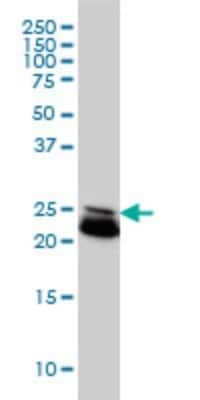 Western Blot: RAB21 Antibody (1F6) [H00023011-M01]