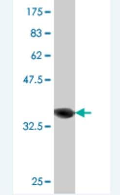 Western Blot: RAB21 Antibody (1G4) [H00023011-M03]