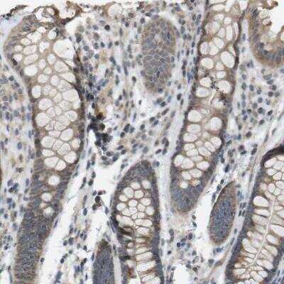 Immunohistochemistry-Paraffin: RAB21 Antibody [NBP1-81544]