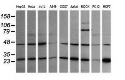 Western Blot: RAB21 Antibody (OTI6E12)Azide and BSA Free [NBP2-73769]