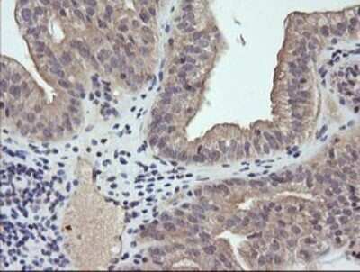 Immunohistochemistry: RAB21 Antibody (OTI6E12) [NBP2-45497]