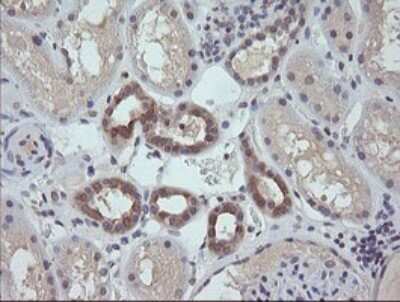 Immunohistochemistry: RAB21 Antibody (OTI6E12) [NBP2-45497]