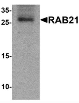 Western Blot: RAB21 AntibodyBSA Free [NBP2-82030]