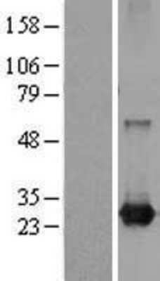 Western Blot: RAB21 Overexpression Lysate [NBL1-15047]