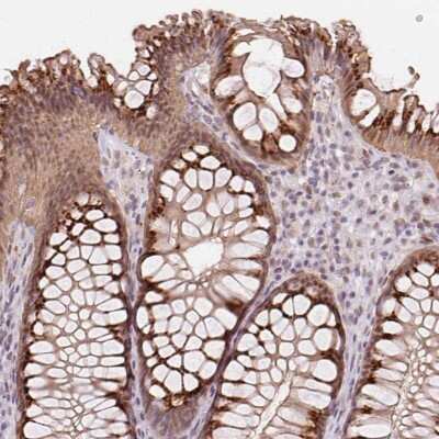 Immunohistochemistry: RAB22A Antibody [NBP2-39080]