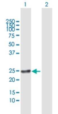 Western Blot: RAB22A Antibody [H00057403-B01P]