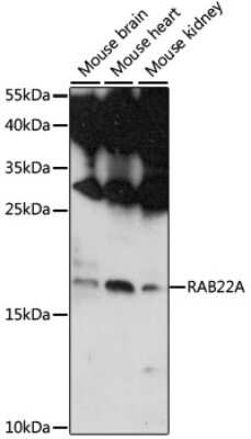 Western Blot: RAB22A AntibodyAzide and BSA Free [NBP2-93060]