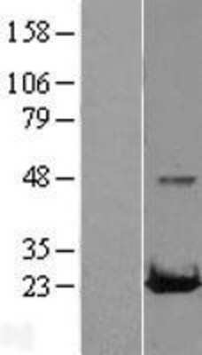 Western Blot: RAB22A Overexpression Lysate [NBL1-15048]