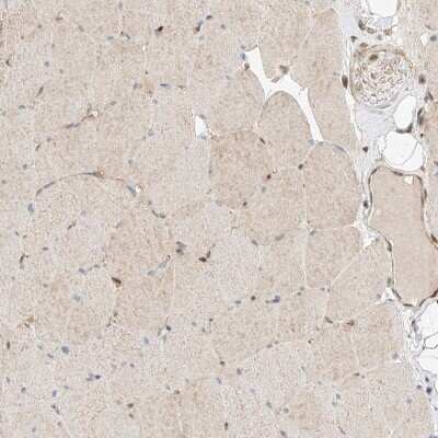 Immunohistochemistry-Paraffin: RAB23 Antibody [NBP1-86366]