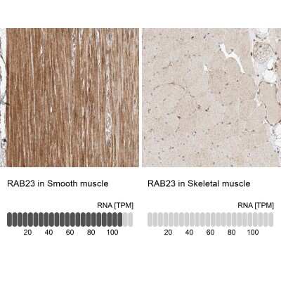 Immunohistochemistry-Paraffin: RAB23 Antibody [NBP1-86366]