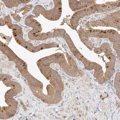 Immunohistochemistry-Paraffin: RAB23 Antibody [NBP1-86367]