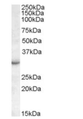 Western Blot: RAB23 Antibody [NBP1-20965]