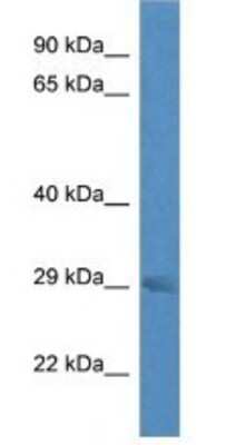 Western Blot: RAB23 Antibody [NBP1-79647]