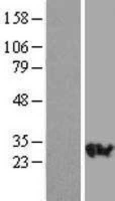 Western Blot: RAB23 Overexpression Lysate [NBL1-15050]