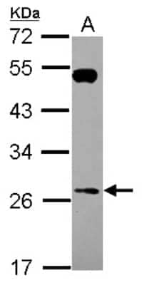 Western Blot: RAB26 Antibody [NBP2-20040]