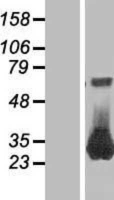 Western Blot: RAB26 Overexpression Lysate [NBL1-15054]