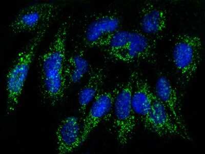 Immunocytochemistry/ Immunofluorescence: RAB27B Antibody [NBP2-97109]