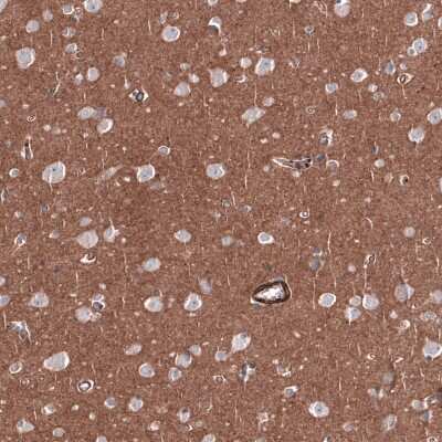 Immunohistochemistry-Paraffin: RAB27B Antibody [NBP1-89538]