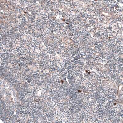 Immunohistochemistry-Paraffin: RAB27B Antibody [NBP1-89538]