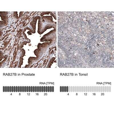 Immunohistochemistry-Paraffin: RAB27B Antibody [NBP1-89538]