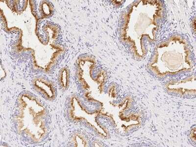 Immunohistochemistry-Paraffin: RAB27B Antibody [NBP2-97109]