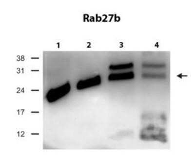 Western Blot: RAB27B Antibody [NBP1-79631]