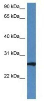 Western Blot: RAB27B Antibody [NBP1-79631]
