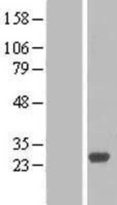 Western Blot: RAB27B Overexpression Lysate [NBL1-15055]