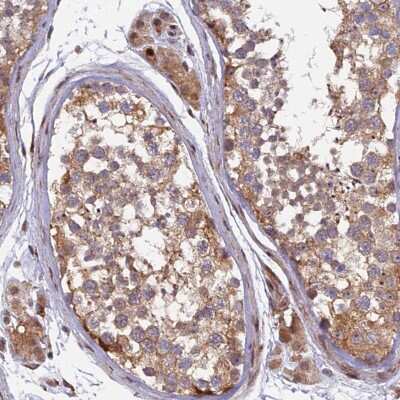 Immunohistochemistry-Paraffin: RAB28 Antibody [NBP1-92308]