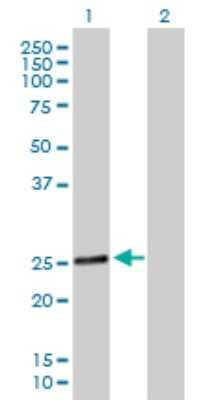 Western Blot: RAB28 Antibody [H00009364-B02P]