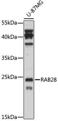 Western Blot: RAB28 AntibodyAzide and BSA Free [NBP3-05176]