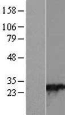 Western Blot: RAB28 Overexpression Lysate [NBL1-15056]