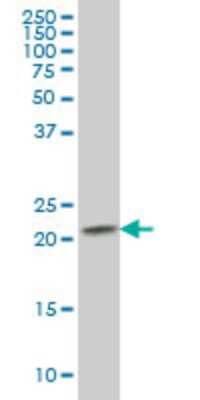 Western Blot: RAB2B Antibody (7E4) [H00084932-M02]