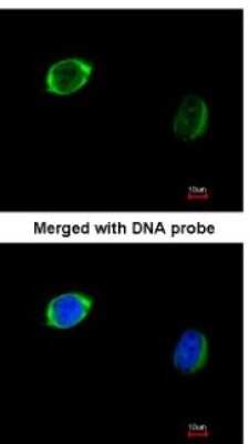 Immunocytochemistry/ Immunofluorescence: RAB2B Antibody [NBP1-31631]