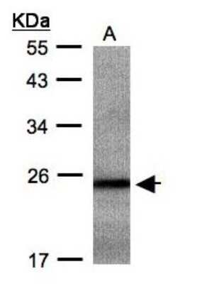 Western Blot: RAB2B Antibody [NBP1-31631]