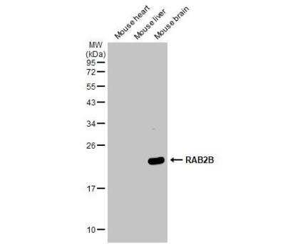 Western Blot: RAB2B Antibody [NBP1-31631]