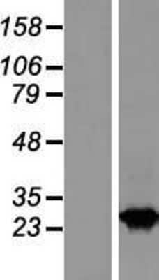 Western Blot: RAB2B Overexpression Lysate [NBL1-15058]