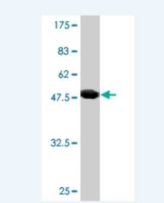 Western Blot: RAB30 Antibody (3G7) [H00027314-M03]