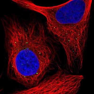 Immunocytochemistry/ Immunofluorescence: RAB30 Antibody [NBP2-30410]