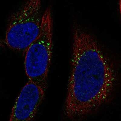 Immunocytochemistry/ Immunofluorescence: RAB30 Antibody [NBP2-55956]