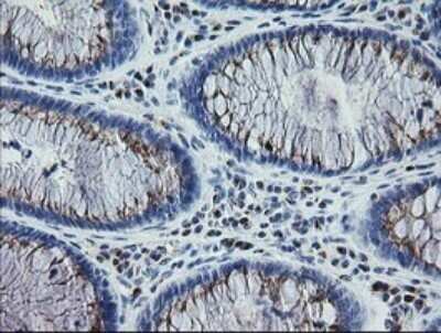 Immunohistochemistry: RAB30 Antibody (OTI3E7) - Azide and BSA Free [NBP2-73771]