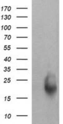 Western Blot: RAB30 Antibody (OTI3E7)Azide and BSA Free [NBP2-73771]