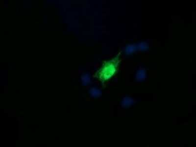 Immunocytochemistry/ Immunofluorescence: RAB30 Antibody (OTI3E7) [NBP2-45498]