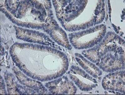 Immunohistochemistry: RAB30 Antibody (OTI3E7) [NBP2-45498]