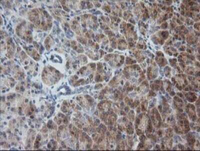 Immunohistochemistry: RAB30 Antibody (OTI3E7) [NBP2-45498]
